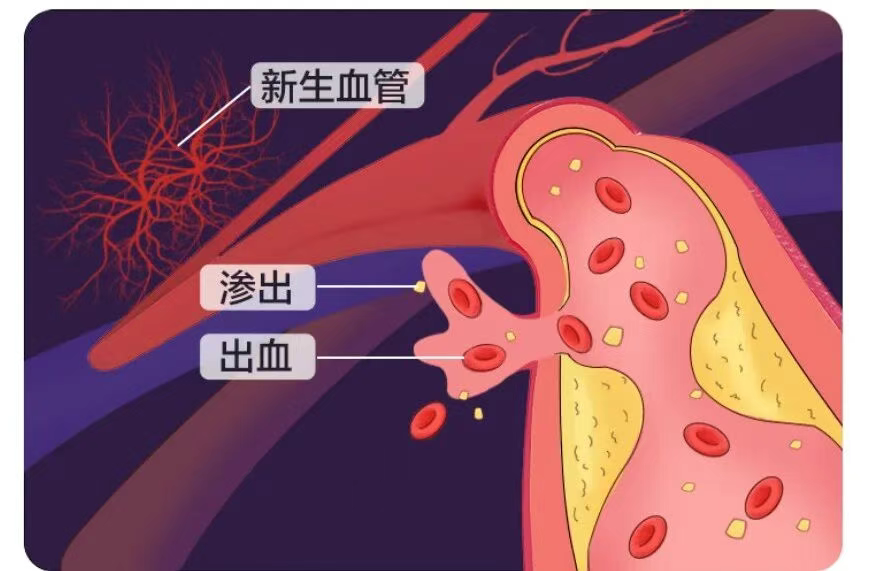 图片.png 图片.png